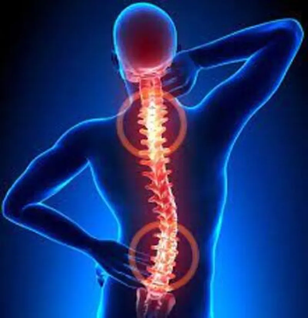 Learn More About Scoliosis